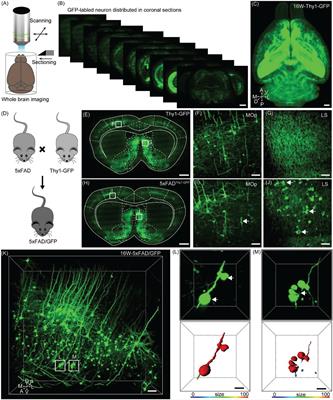 Whole-Brain Three-Dimensional Profiling Reveals Brain Region Specific Axon Vulnerability in 5xFAD Mouse Model